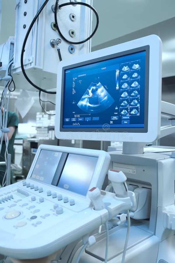 Advance Ultrasound Machine in Hospital Stock Photo - Image of machine, console_ 67359710