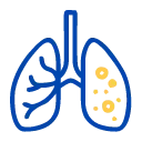 Tuberculosis