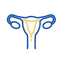Ovarian Cancer